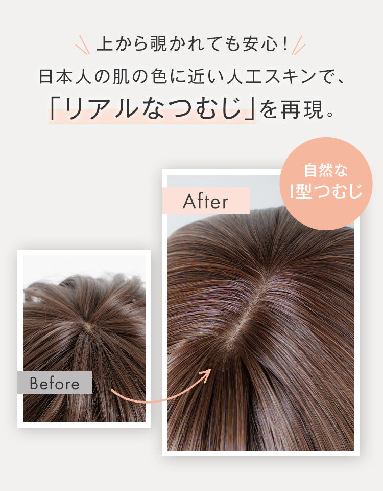 上から覗かれても安心！日本人の肌の色に近い人工スキンで、「リアルなつむじ」を再現。自然なI型つむじ。