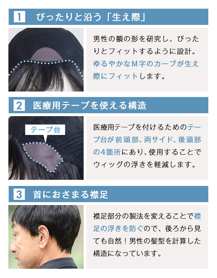 ロイヤルショート人毛MIX  ぴったりと沿う生え際。医療用テープを使える構造。首におさまる襟足。
