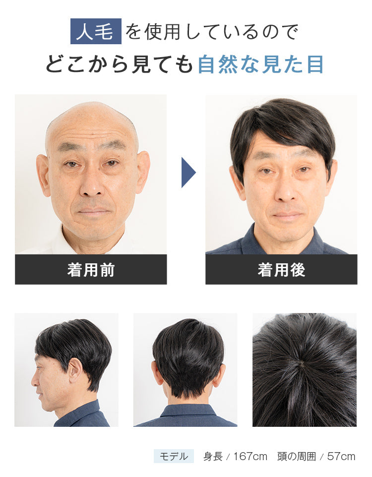 人毛を使用しているのでどこから見ても自然な見た目