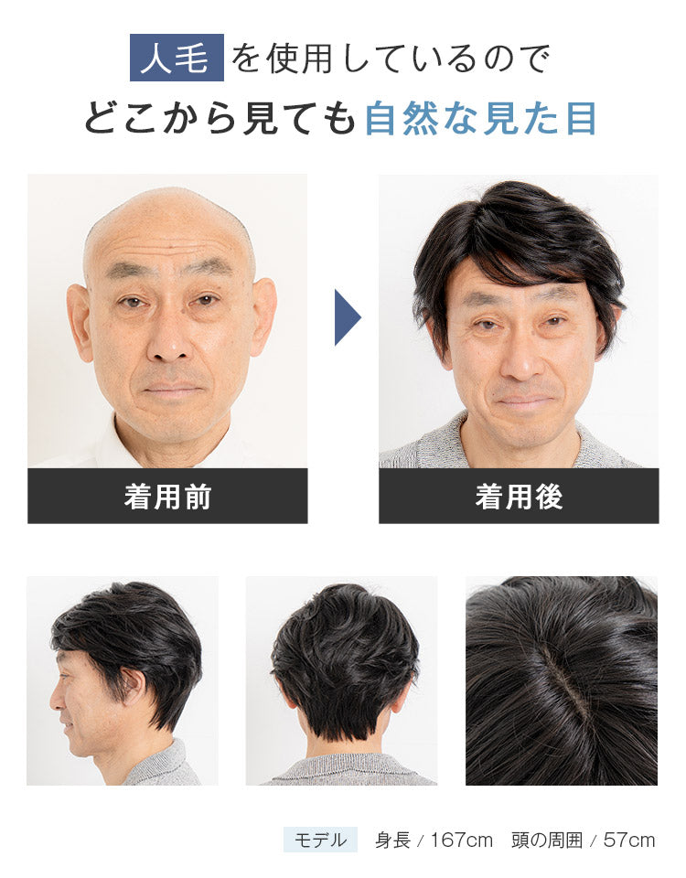 人毛を使用しているのでどこから見ても自然な見た目