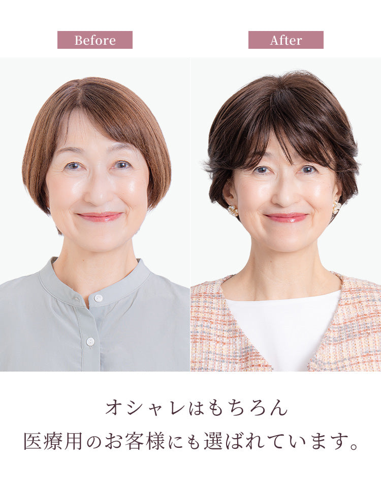 オシャレはもちろん、医療用のお客様にも選ばれています。