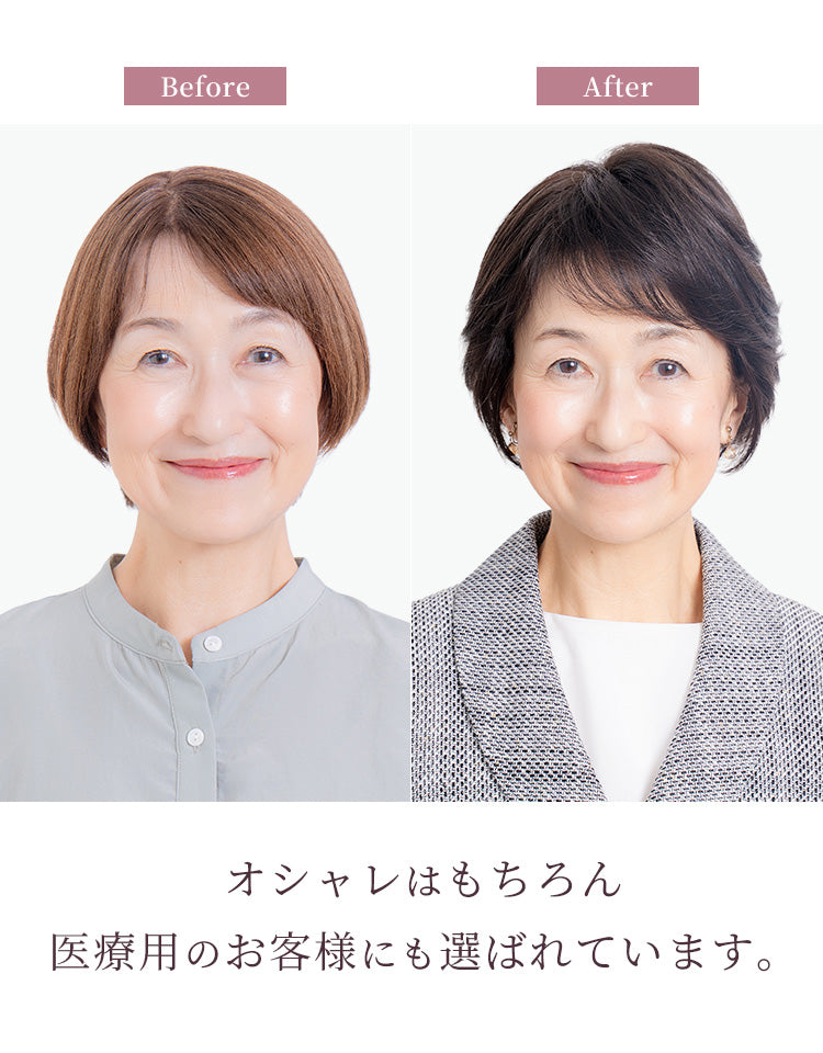 オシャレはもちろん、医療用のお客様にも選ばれています。